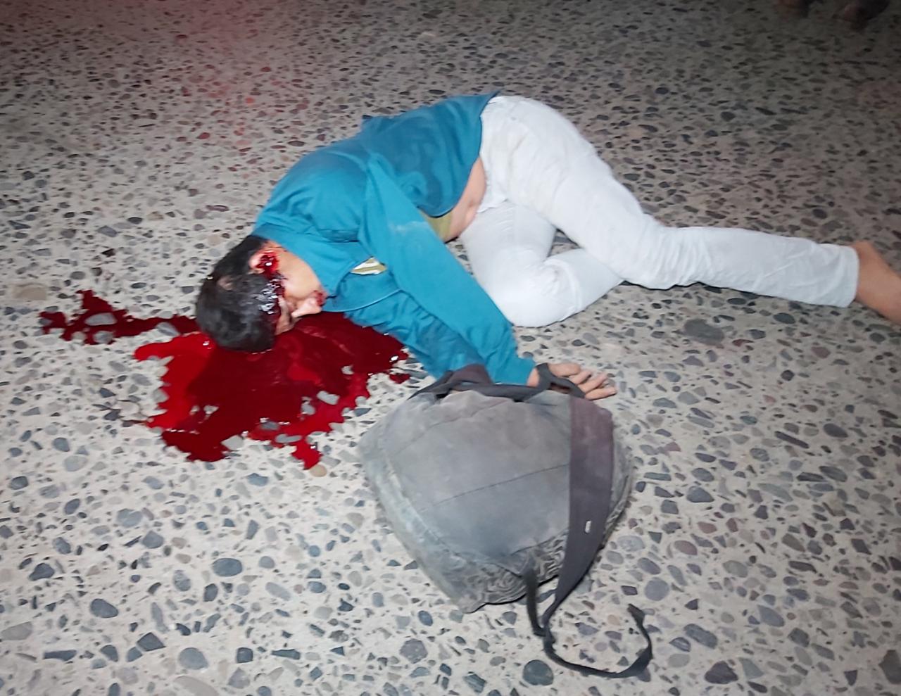 Campesino muere atropellado en Tihuatlán