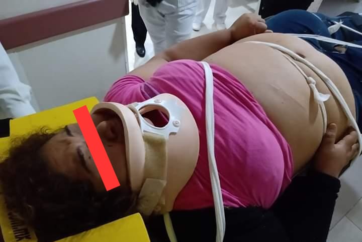 Patrulla de Fuerza Civil atropella a  pareja en Tierra Blanca, muere el hombre