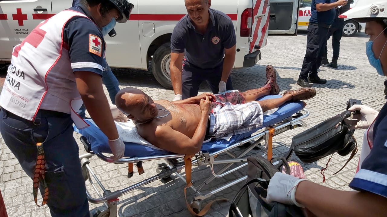 Golpean y navajean a marino retirado en la zona de mercados