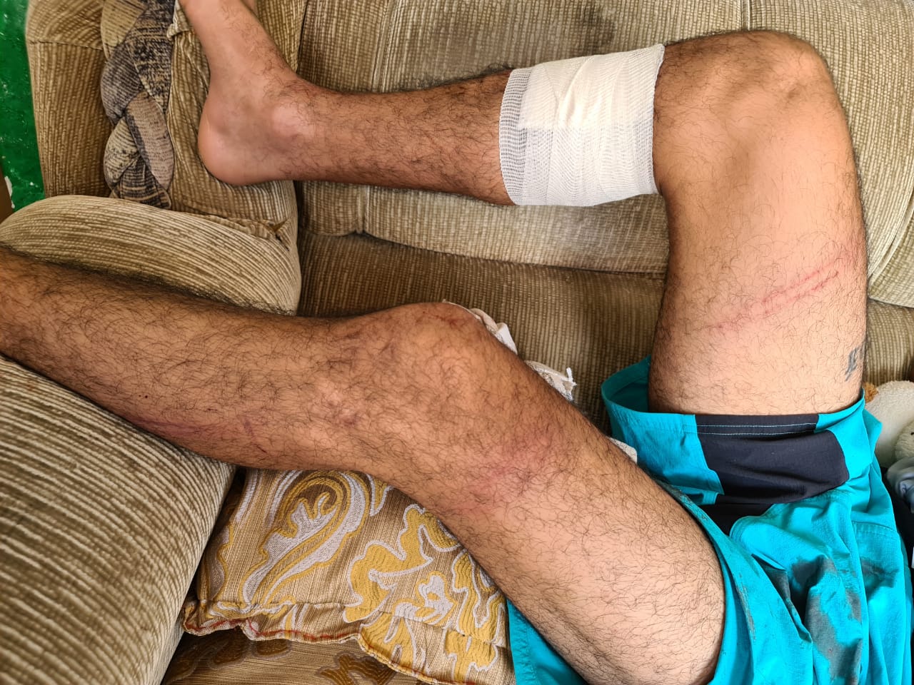 Regidor panista agarra a tubazos a su hermano en Veracruz puerto