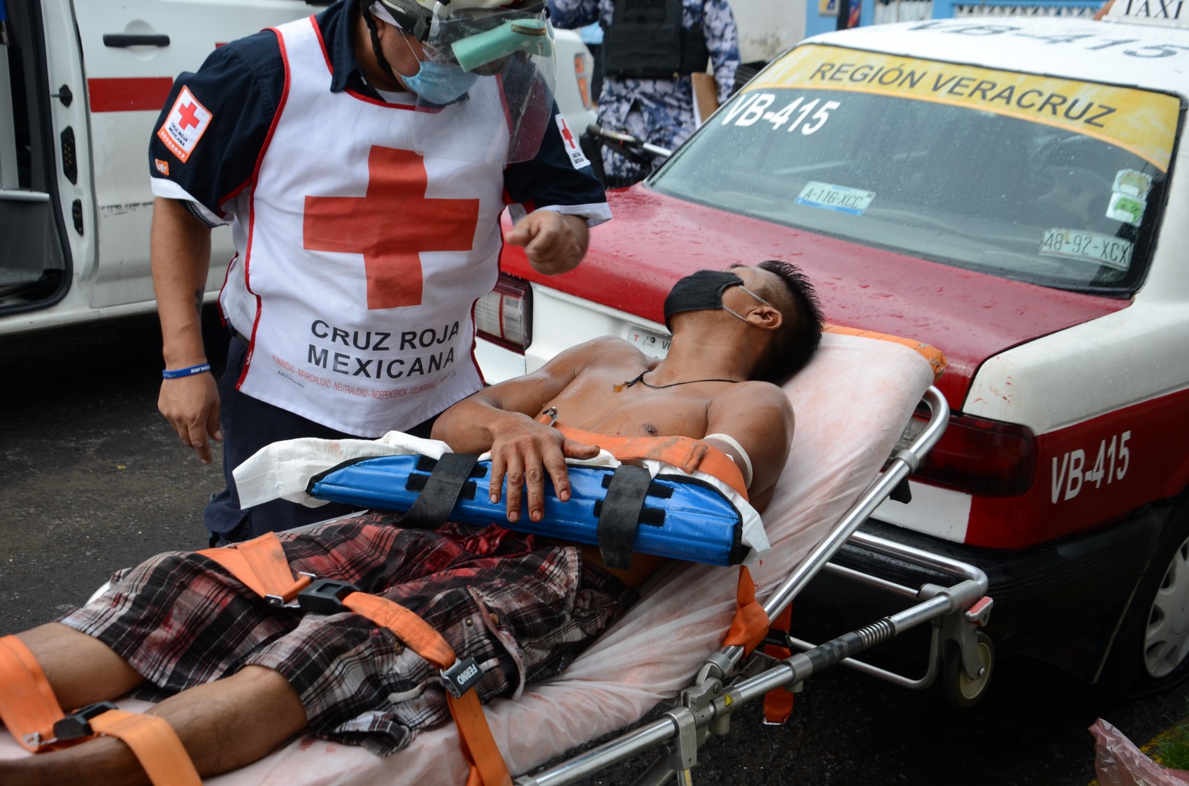 Casi le amputan la mano en riña en Veracruz