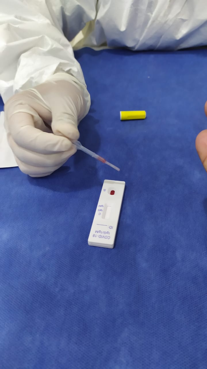 Más de 500  pacientes esperan desde hace meses resultados de prueba Covid