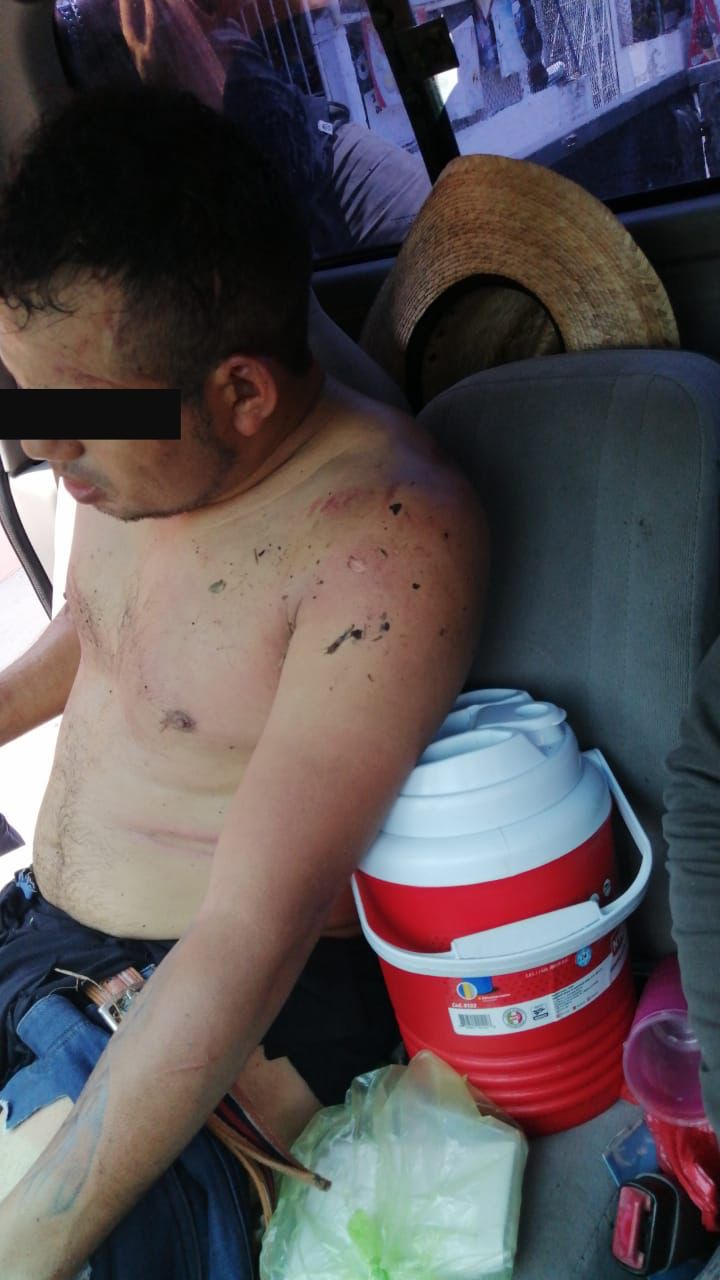 Denuncian nuevo caso de supuesto  abuso policial en Tierra Blanca