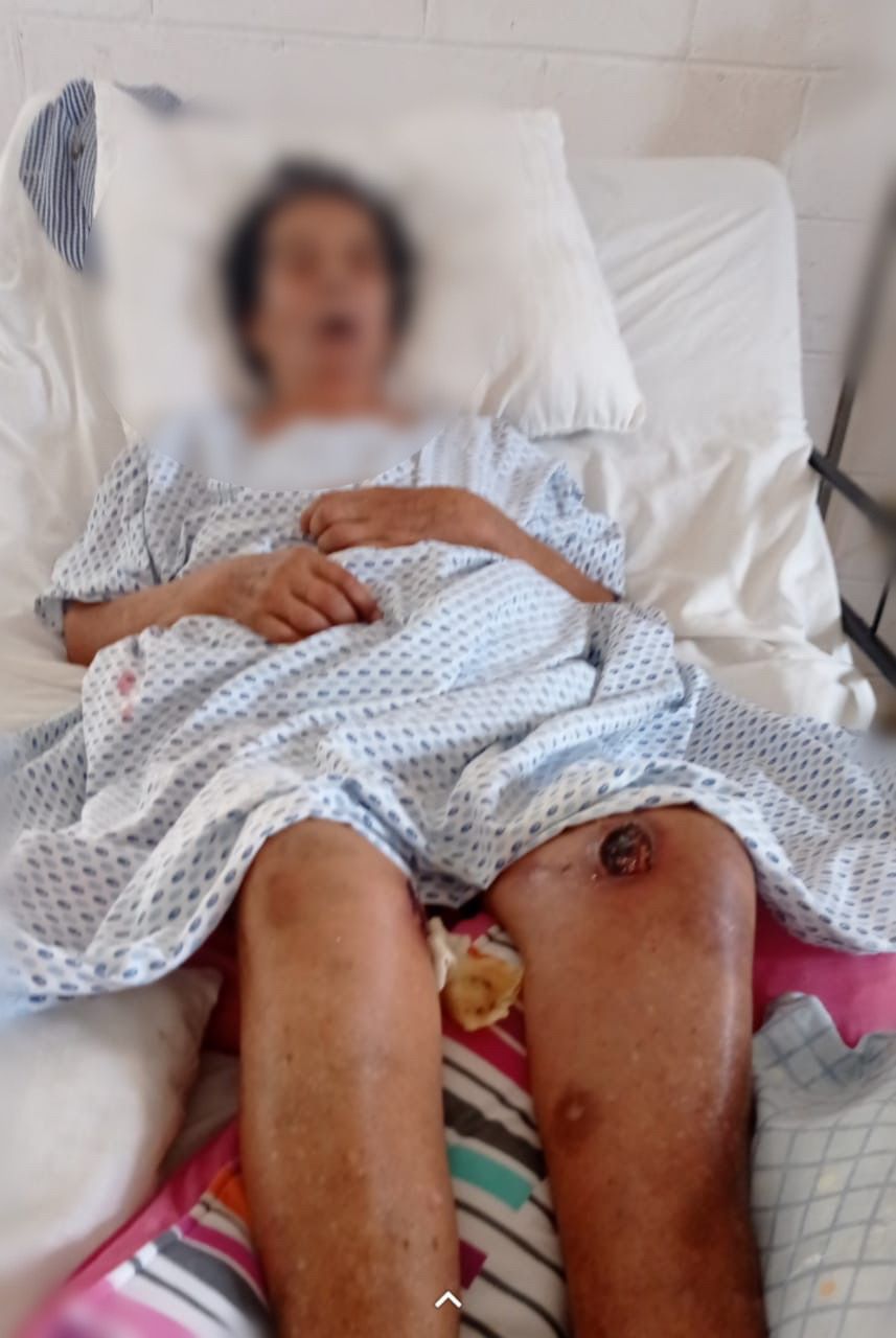 Muere abuela en albergue del DIF de Veracruz, familia acusa que tenía lesiones