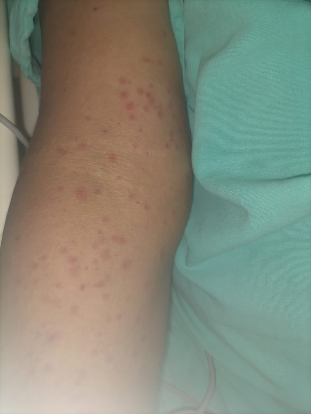 Denuncian infestación de moscos en área COVID de hospital del IMSS en Veracruz puerto