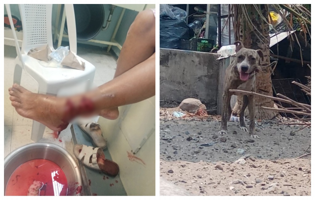 Se registra otro ataque de Pitbull a mujer de la tercera edad en Veracruz