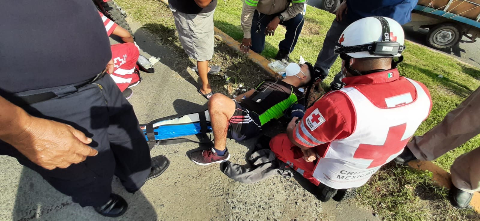 Motociclista se estrella contra urbano en Río Medio, podría perder la pierna