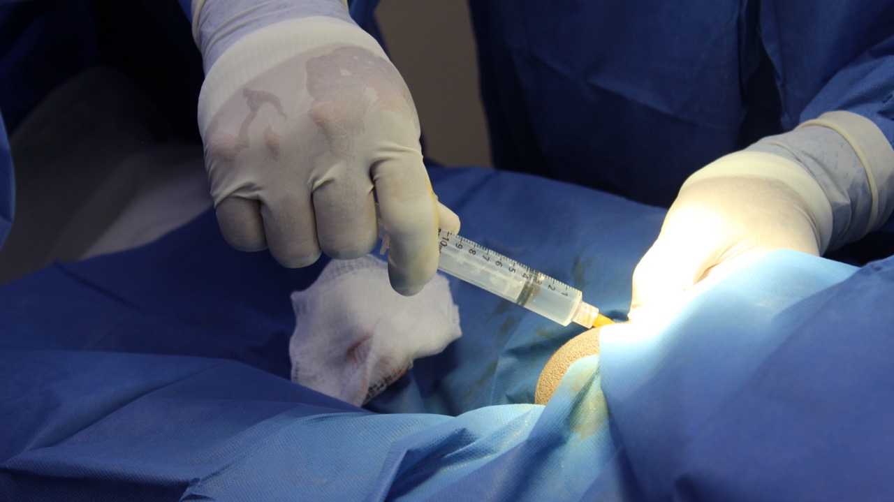 Vasectomia por una paternidad responsable: IMSS