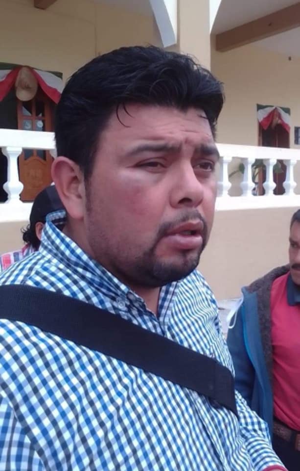 Regidor de Ayahualulco es golpeado por negarse a aprobar la Cuenta Pública