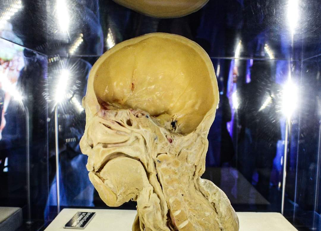 Presentan la Expo Bodies, Cuerpos Humanos Reales en la plaza Andamar de Boca del Río