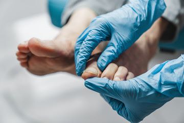 Ante el primer indicio de onicomicosis, es necesario acudir al médico: Especialista