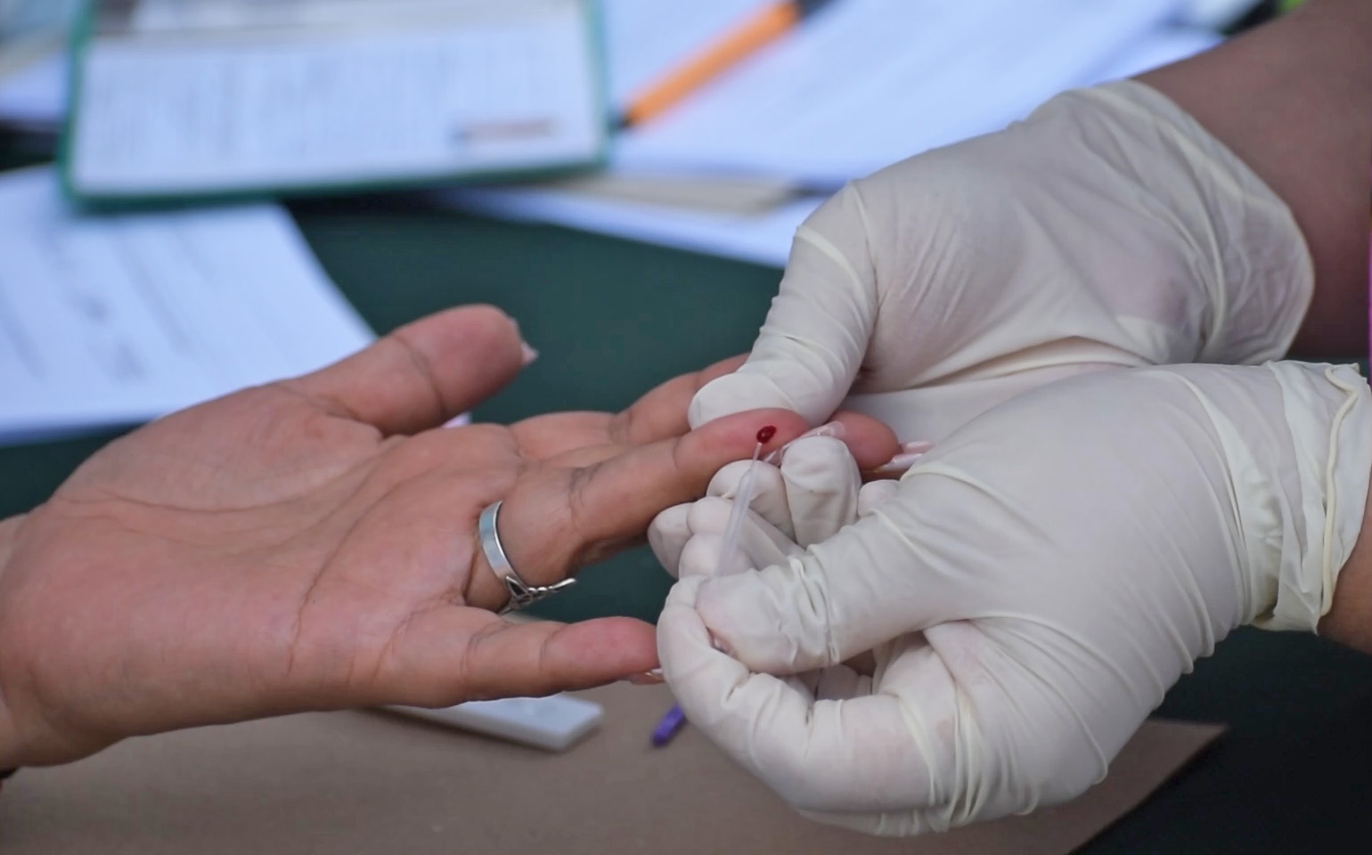 Recomiendan identificar sintomatología por hepatitis C
