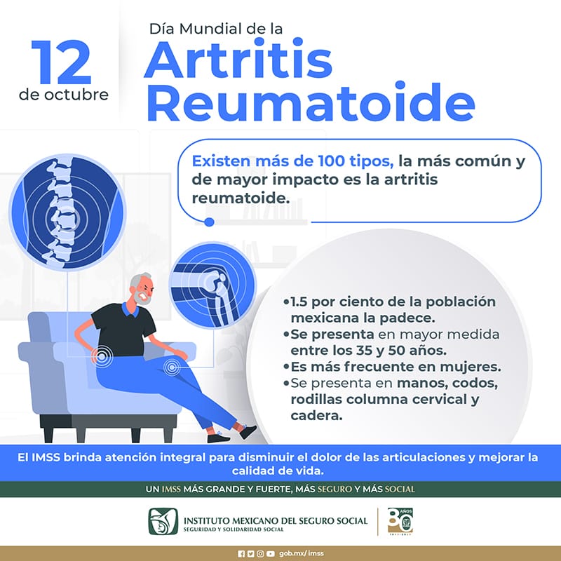 Importante identificar síntomas de la artritis reumatoide para evitar complicaciones