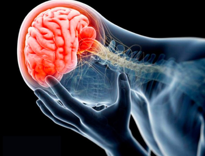 Graves consecuencias si no se trata adecuadamente la meningitis