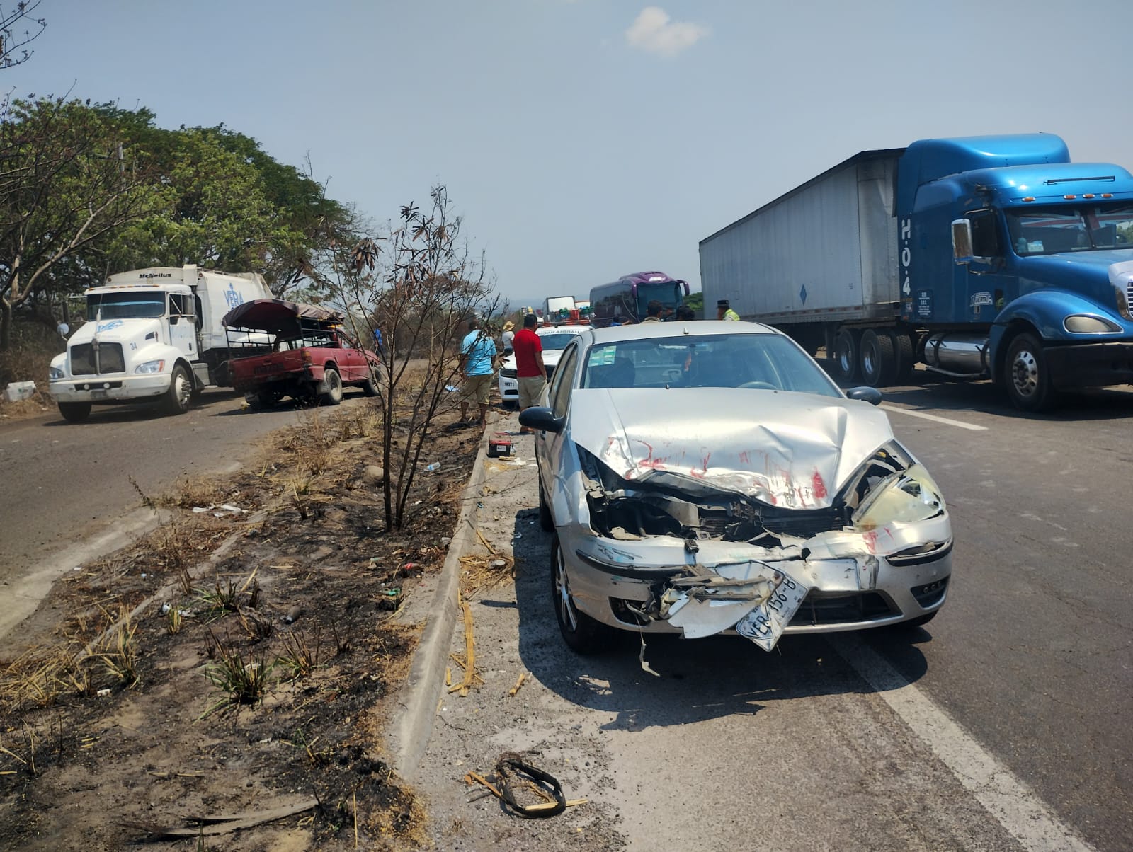 Accidente deja dos mujeres lesionadas, una de ellas menor de edad, en Santa Fe, Veracruz
