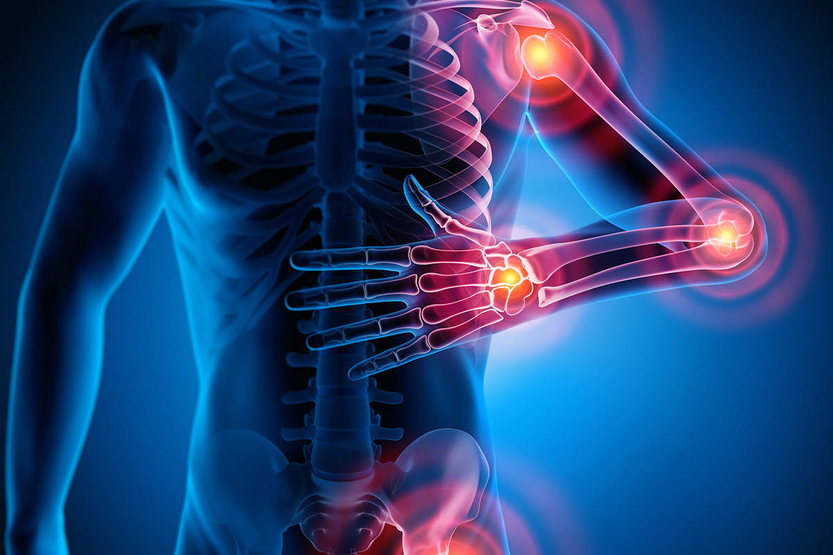 Fibromialgia, enfermedad crónica e invalidante