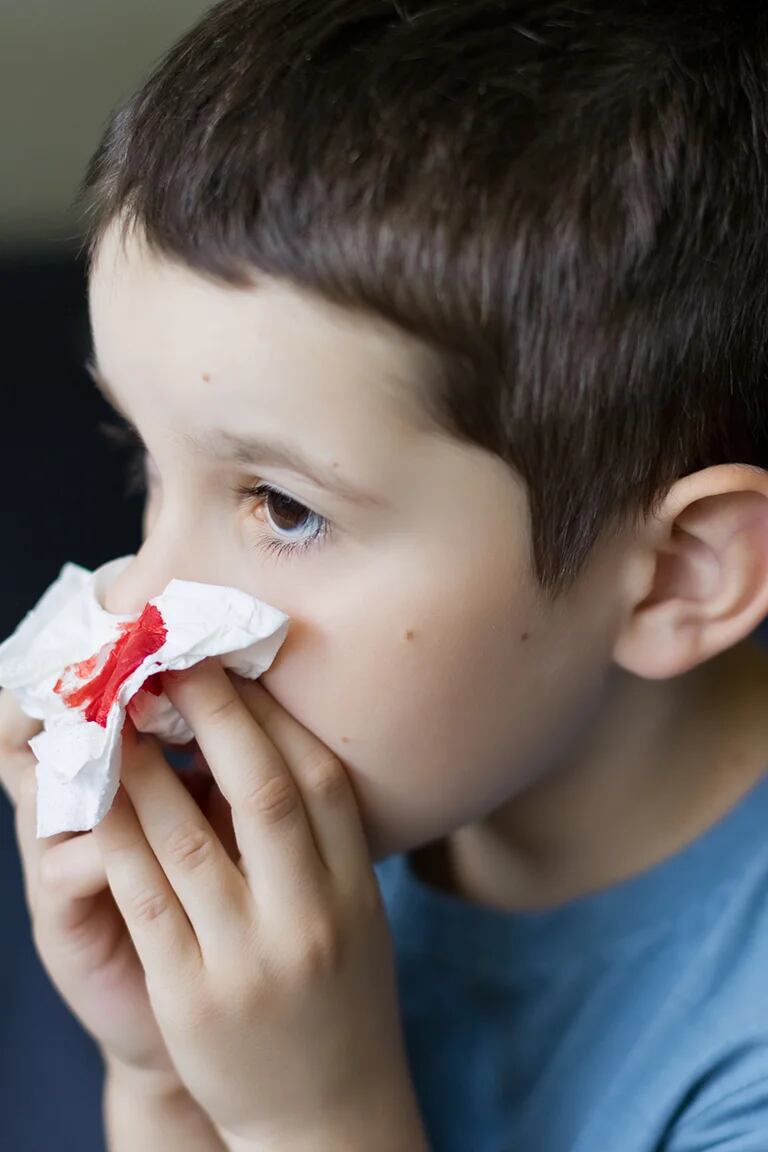 Tratada a tiempo, la leucemia infantil se puede curar: IMSS