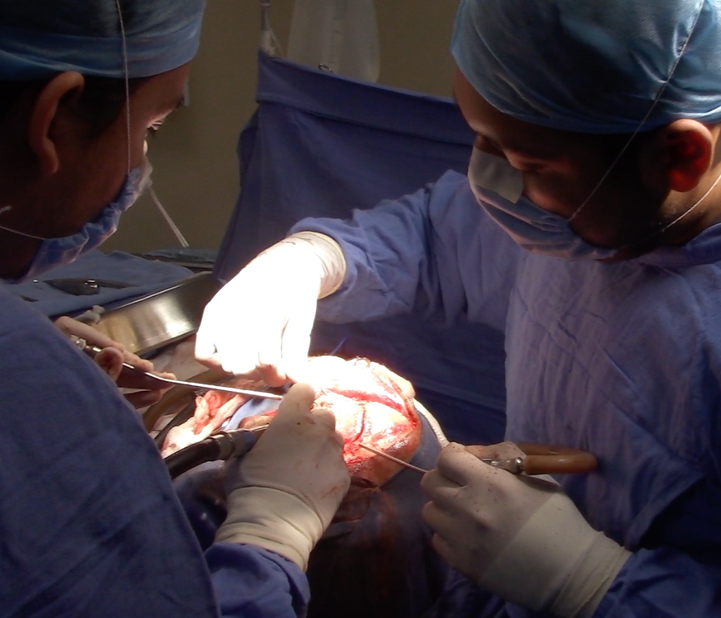 Accidente cerebrovascular puede ocasionar la muerte de 1.9 millones de neuronas en un minuto