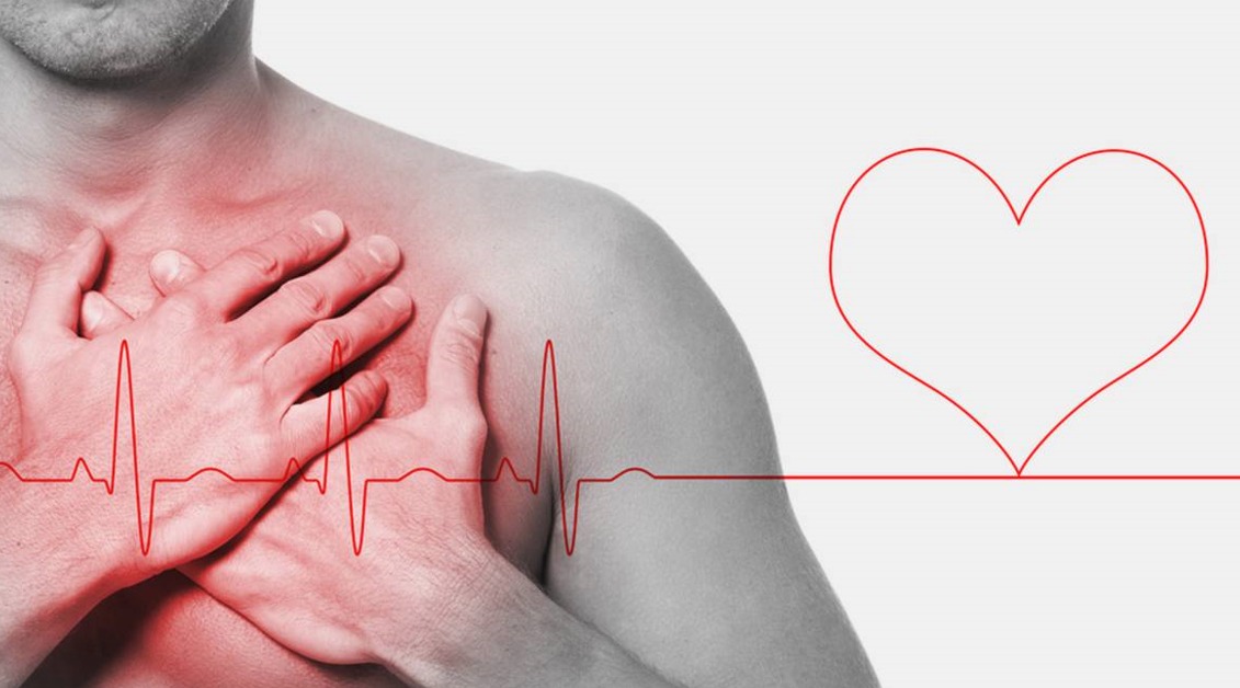 ¿Sabes cuáles son los síntomas del síndrome del corazón navideño?