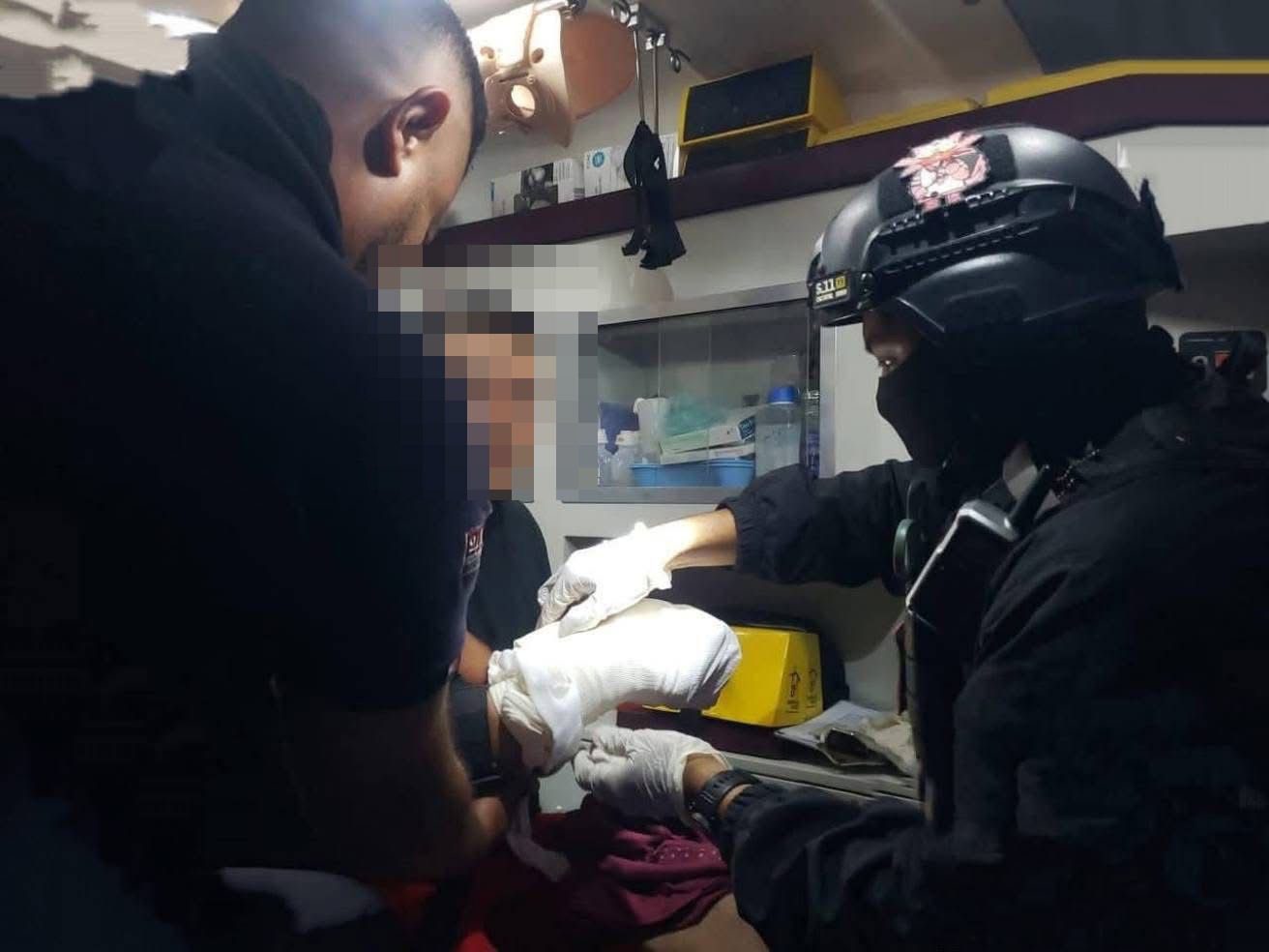 Hombre pierde tres dedos al manipular pirotecnia en Nopaltepec