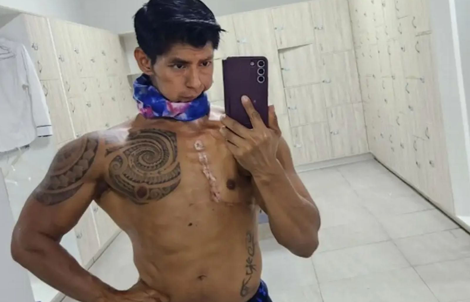 Fisicoculturista veracruzano lucha por reconstruir su rostro tras superar cáncer maxilofacial