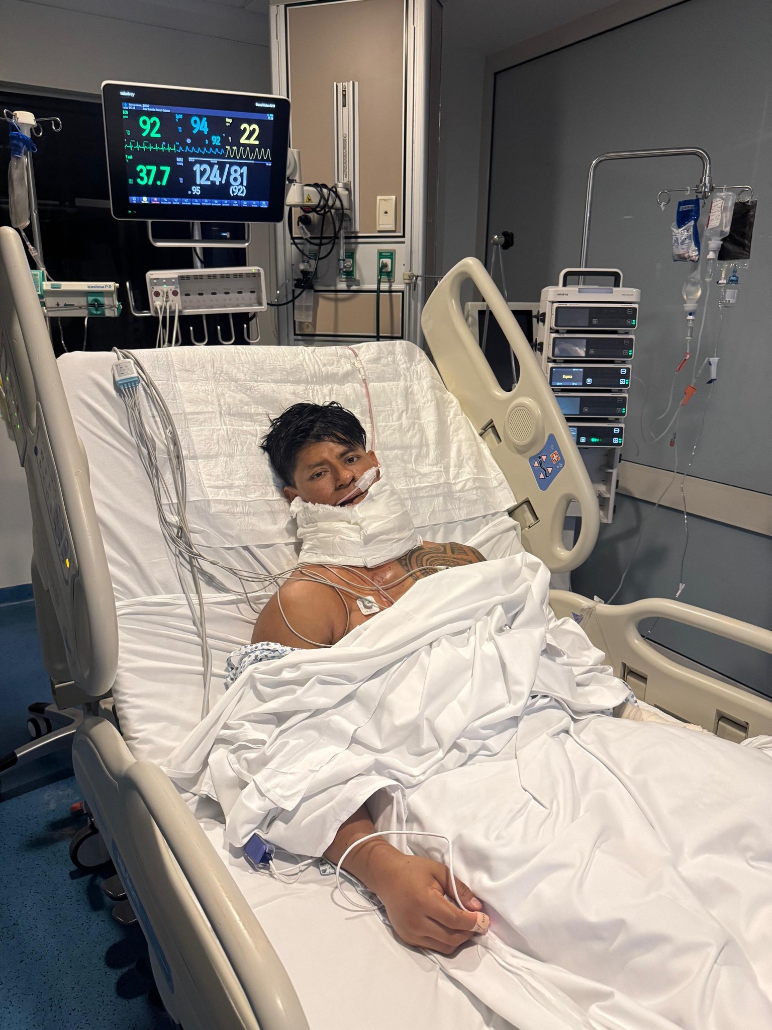 Hernerl de Sosa, veracruzano que perdió la mandíbula por cáncer, vive nueva lucha