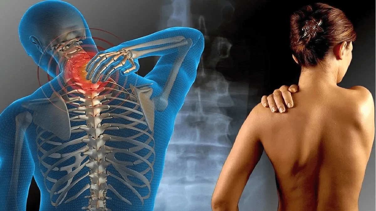 El dolor no se ve, pero existe: mujeres con fibromialgia piden visibilidad y trato digno