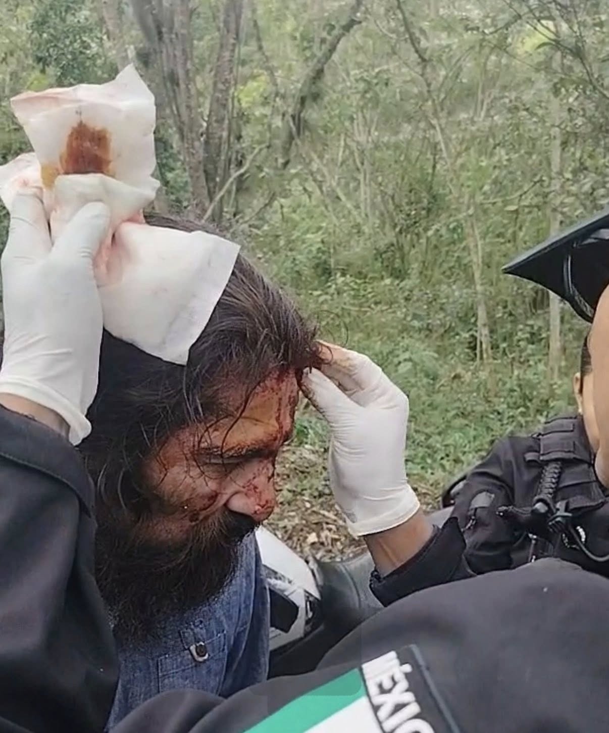 Ataque a activista de la Cooperativa Bosque Don Roberto genera movilización policiaca en Xalapa
