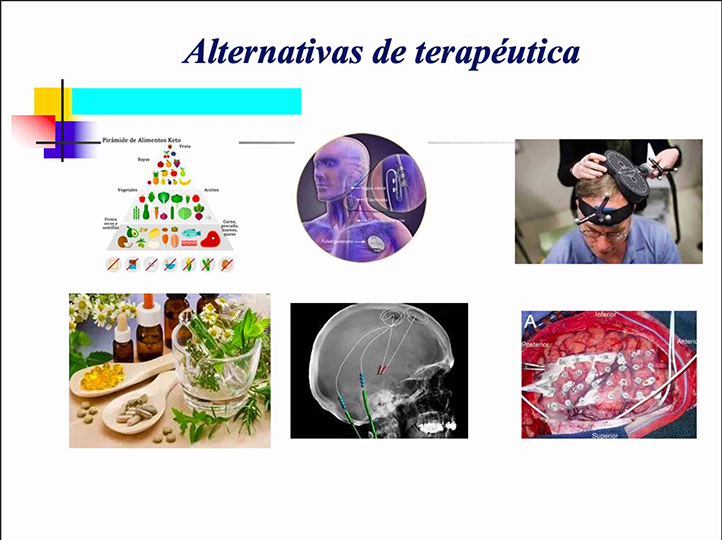 Pacientes con epilepsia requieren un tratamiento integral y específico