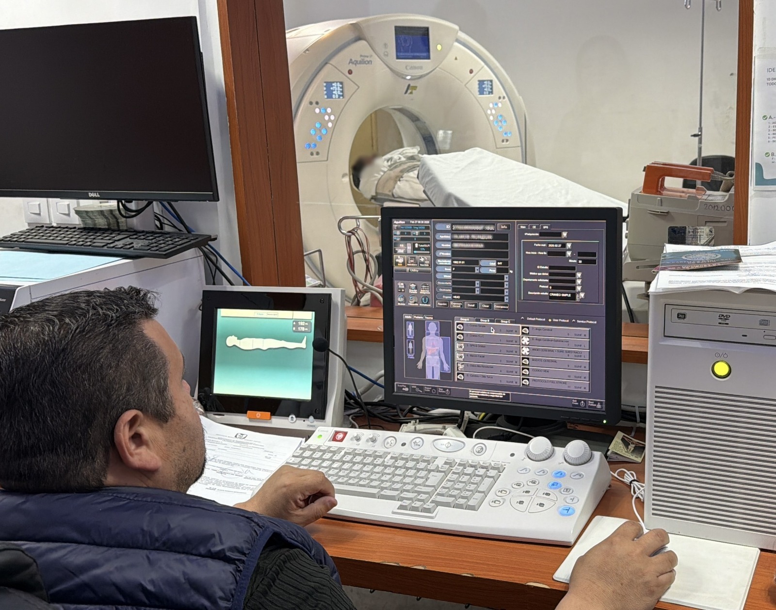 Cómo detectar un infarto cerebral a tiempo, según expertos