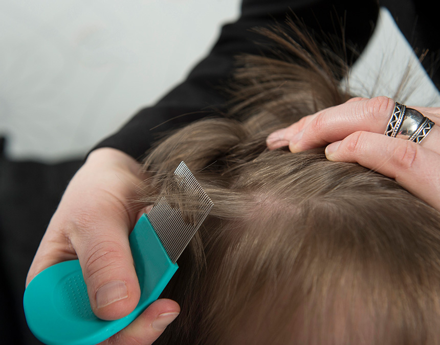 Alertan por aumento de casos de piojos en niños y niñas escolares